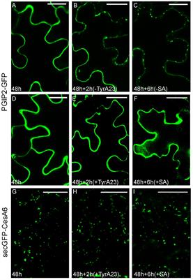 CesA6 and PGIP2 Endocytosis Involves Different Subpopulations of TGN-Related Endosomes